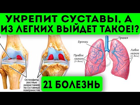 Этот народный настой из обычного розмарина лечит 21 болезнь! Суставы, легкие, грибок, омоложение и..