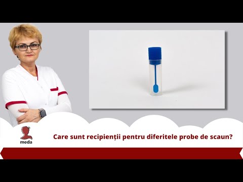 Care sunt recipienții 👉 pentru diferitele probe de scaun?