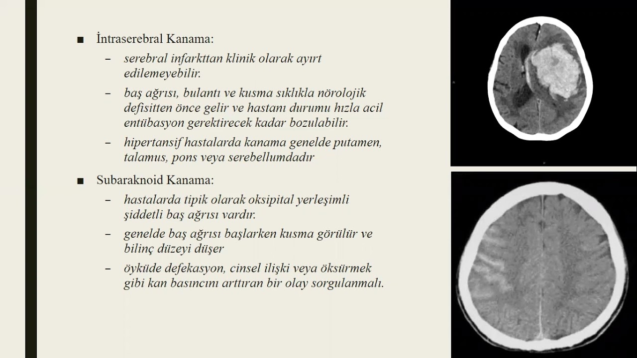 Acil Serviste SVH Yaklaşımı