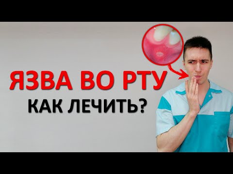 Видео: Как быстро снять жар (с иллюстрациями)