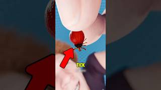 Never Rip Out a Tick! The Dangerous Mistake That Could Cause Infection