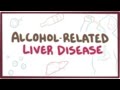 Alcoholrelated liver disease  causes symptoms  pathology