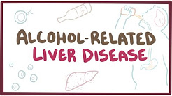 Alcohol-related liver disease - causes, symptoms & pathology