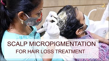 Scalp Micro pigmentation (SMP) | Common Questions | Tamira Plastic Surgery