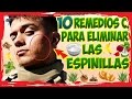 Quita las Espinillas Barros Puntos Negros al instante con estos 10 remedios caseros