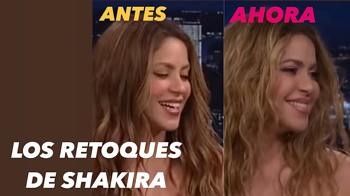 ¿Qué le pasa a Shakira en la cara? Los retoques estéticos a los que se ha sometido a la colombiana