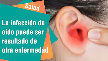 ¿Qué aspecto tiene una infección de oído grave?