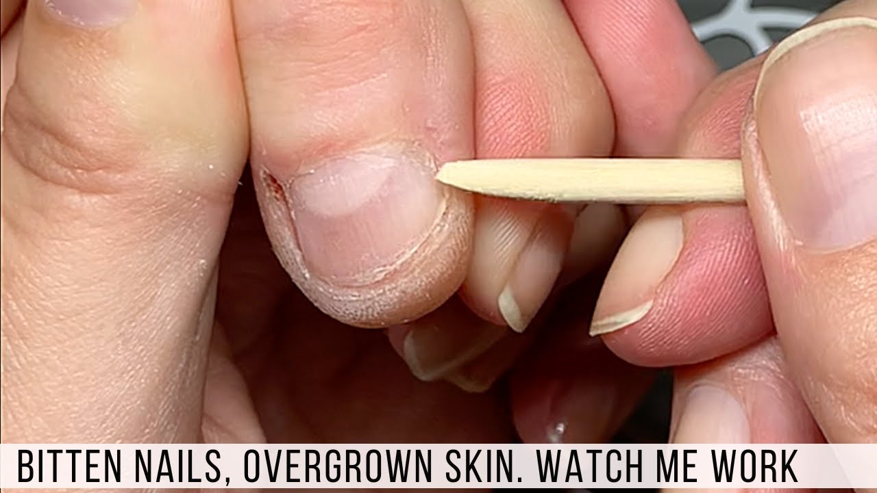 Ways to trim kids nails - Today's Parent