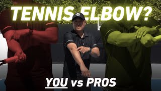 Why YOU Get Tennis Elbow and Pros Don't