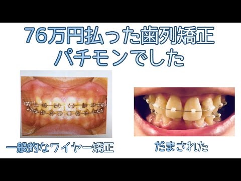 歯列矯正大失敗 ふり出しに戻って2回目の病院選びを始めましたが Youtube 歯列矯正大失敗 ふり出しに戻って2回目の病院選びを始めましたが Youtube