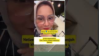 Wajah Baru Elma Theana shortviral elmatheana artist oplas korea