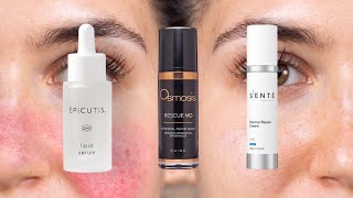 Easy 3-Step Rosacea / Sensitive Skin Routine