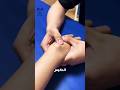 ماذا تفعل اذا رايت هذا التورم في يدك