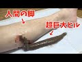 超巨大ヒルに人間の血を与えた結果！？