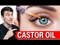 Castor oil for your eyes dry eyes eye bags eye floaters cataracts