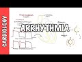 Arrhythmia Overview - Mechanism of bradyarrhythmia and tachyarrhythmia