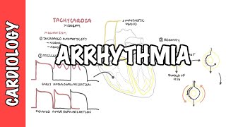 Arrhythmia Overview - Mechanism of bradyarrhythmia and tachyarrhythmia