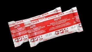 One More Step By GOVT OF INDIA To Remove Malnutrition : Ready-to-Use Therapeutic Food (RUTF)
