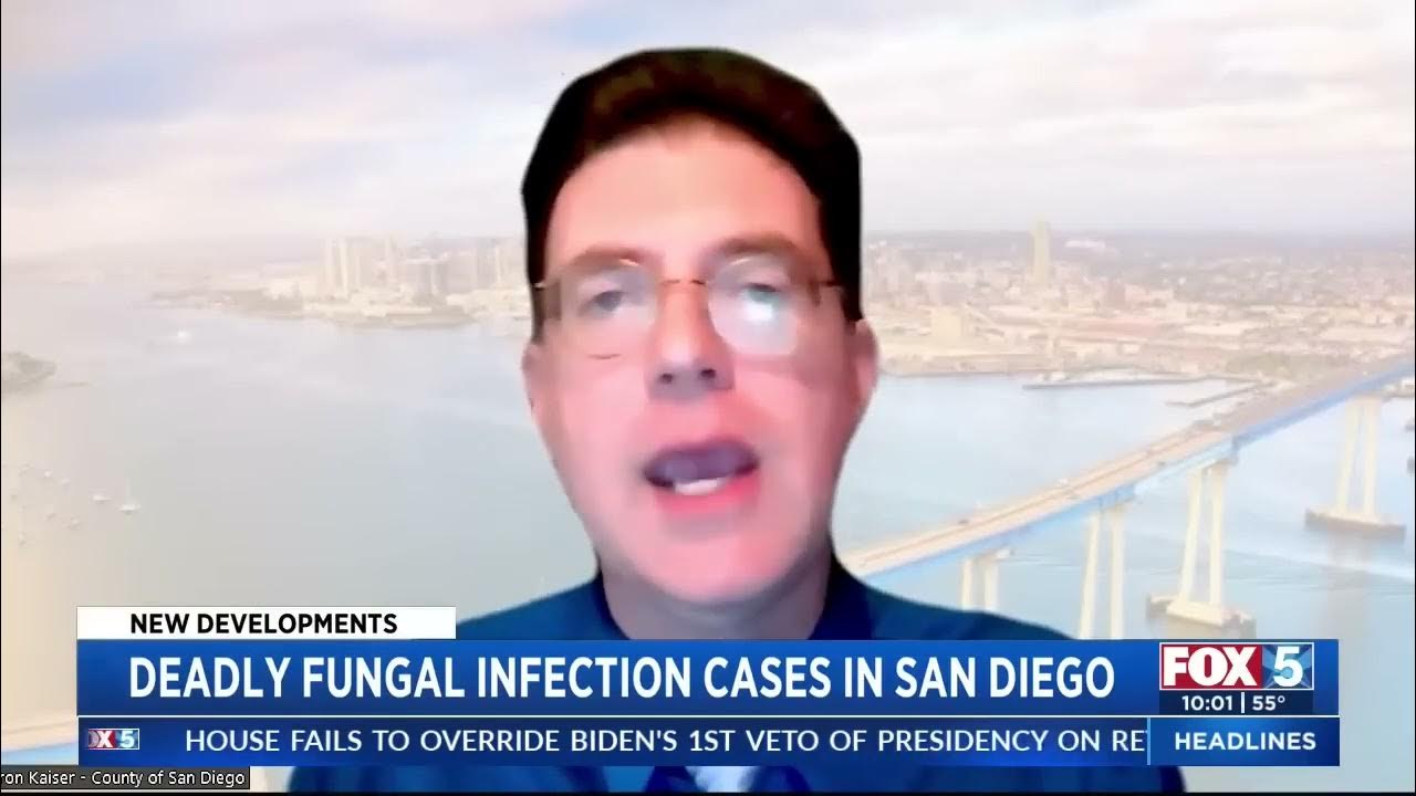 Deadly Fungal Infection Cases In San Diego YouTube