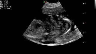 45 day dog pregnancy from VIS training day Secrets Revealed How Vets Diagnose Dog Pregnancies In 24 To 45 Days Profgnp