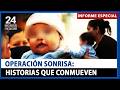 Operación Sonrisa Perú devuelve la sonrisa a decenas de menores vulnerables