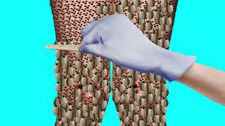 Asmr Treatment 2D Animation Trypophobia Foot Healasmr914K