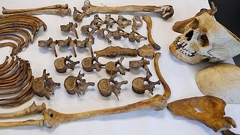 Identifying the dead through science at N.J.’s Forensic Anthropology Laboratory