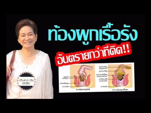ท้องผูก ถ่ายไม่สุด ร่างกายสะสมพิษ| 60+ | ท้องผูกในผู้สูงอายุ |@Health & Spa GURU by พรรณวลัย |Ep192