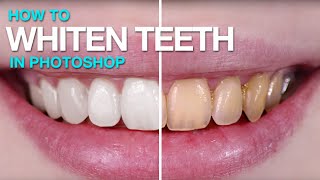 How to Whiten Teeth in Photoshop