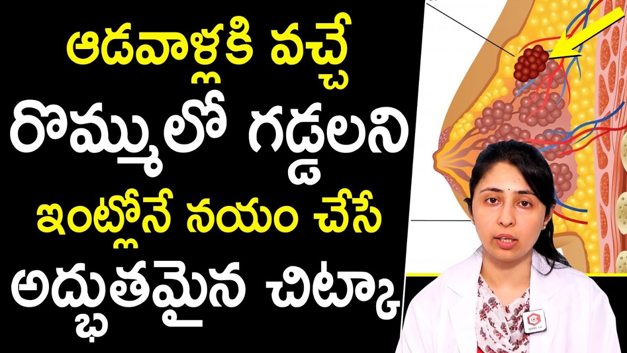 Home Remedies For Brest Lumps | Breast lumps : Causes, Types, Checking, and Home Treatment