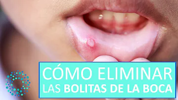 ¿Cómo se llaman las bolas que tienes en los labios?