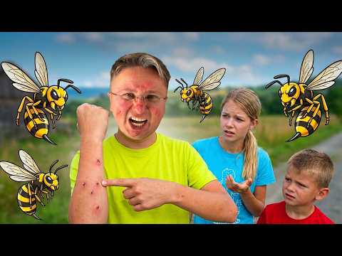 😱 DAD stung by WASPS 🐝 What happened? 😭