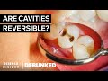 Dentists Debunk 15 More Teeth Myths | Debunked