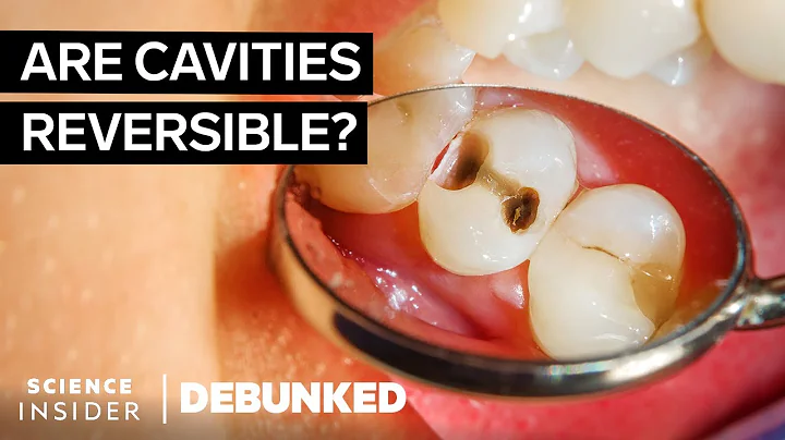 Dentists Debunk 15 More Teeth Myths | Debunked - DayDayNews