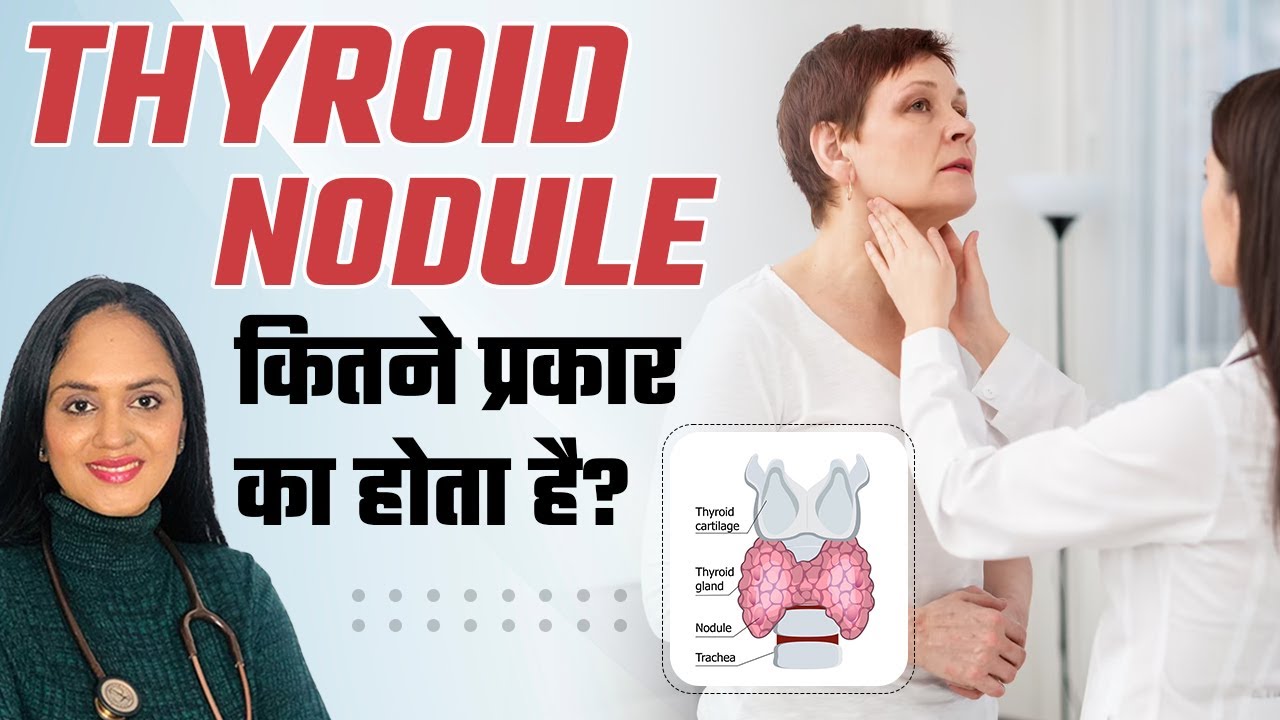 Thyroid nodule thyroid nodule treatment dr