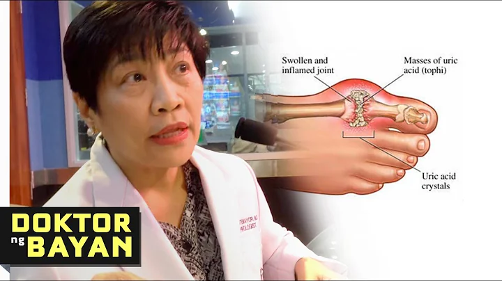 Tips sa Mataas na URIC ACID - ni Dr Elizabeth Mont...