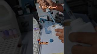 Serum Total Bilirubin Test Kaise Karte Hain? 🧪 | Lab Procedure #shorts  #labtechnician #pathology