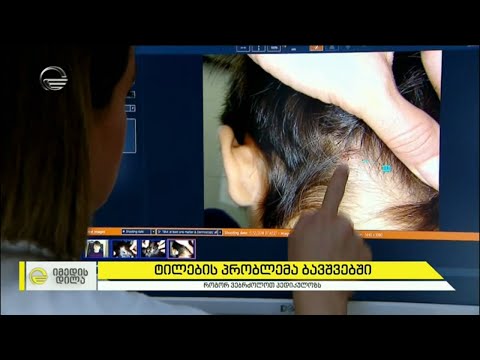 ტილების პრობლემა ბავშვებში და მკურნალობის საშიში გადაწყვეტილება