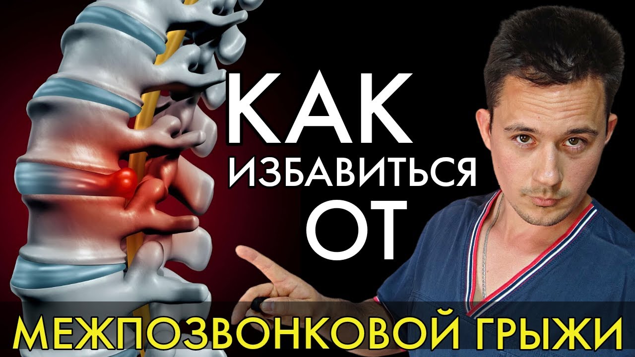 Межпозвонковая грыжа | Лечение без операции | Остеохондроз позвоночника ...