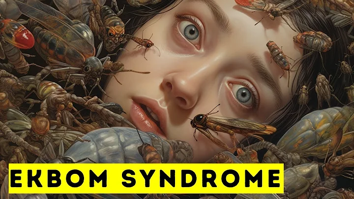 Ekbom Syndrome | 5 Minute Mental Health Documentary