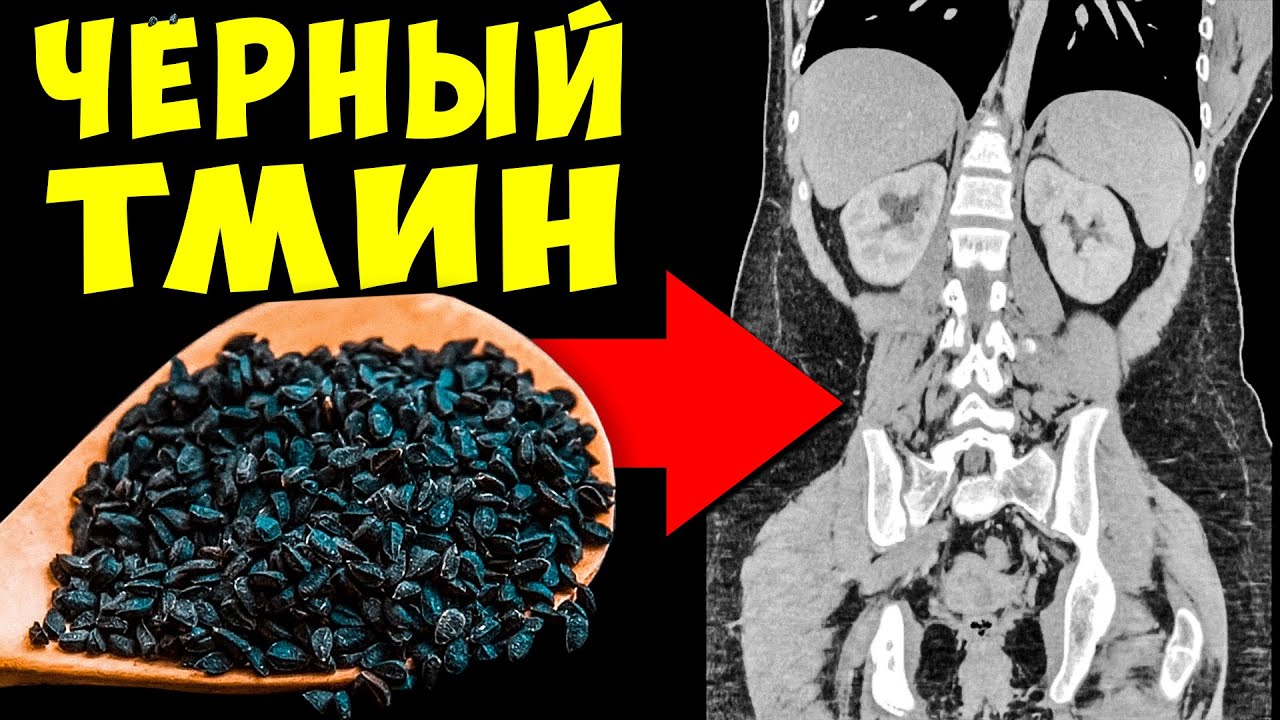 Вот что Творит обычный Чёрный Тмин, если Есть его Каждый день