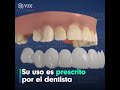 Dientes perfectos en segundo