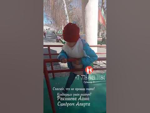 Айша Ракишева 9 лет, нужна помощь! Синдром аперта. - YouTube