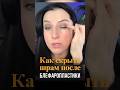 Как скрыть шрам после блефаропластики