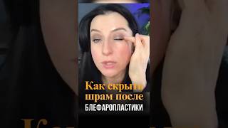 Как скрыть шрам после блефаропластики