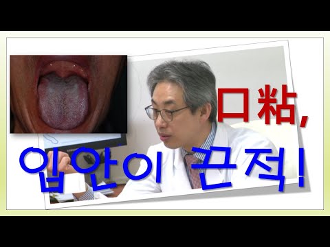 입안이 끈적, 침에 거품이 많은 이유; 구점. 구강건조증의 원인, 타액 분비가 줄어들고 타액조성의 변화로 두터운 설태, 거품 침이 많아져. 입안 이상감각을 구별해야!!