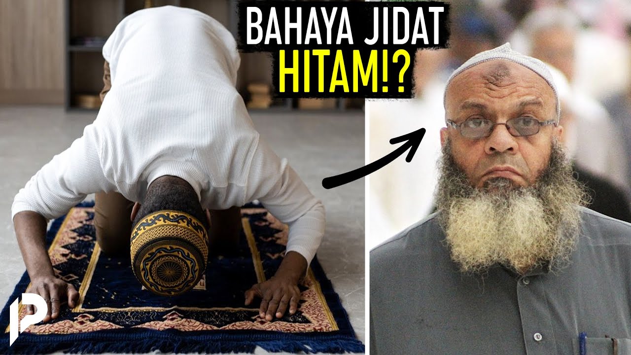Jidat Hitam Tanda Rajin Salat, Tapi Dibenci Rasulullah..