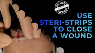 How To Apply Steri-Strips To A Laceration - Wound Closure Erfly