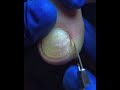 Relaxing Toe Care | Neat and Gentle Nail Trim
