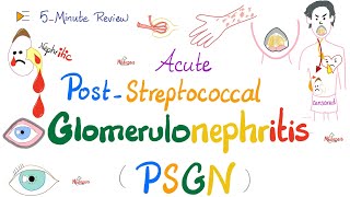 Acute Post-Streptococcal Glomerulonephritis (APSGN) | Nephritic Syndrome | Kidney Pathology